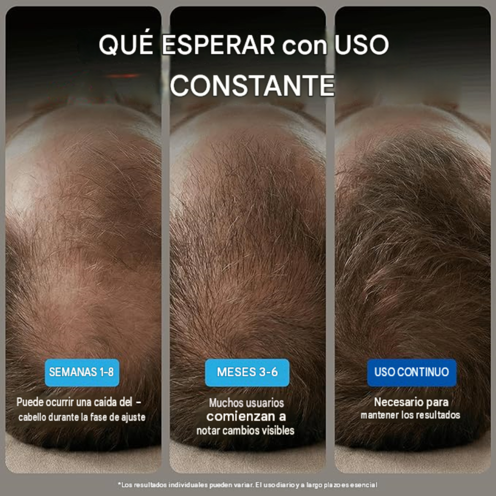Minoxidil Solución Tópica USP 5% | Para el Crecimiento Capilar